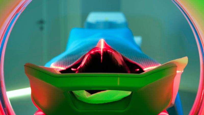 Augmentation des cas de cancer chez les jeunes